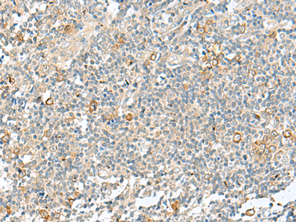 Rabbit Polyclonal Antibody to ECD