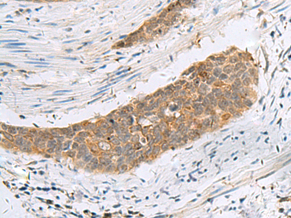 Rabbit Polyclonal Antibody to ECD