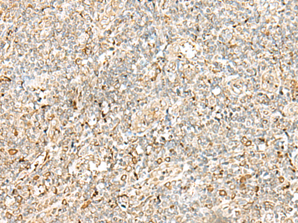 Rabbit Polyclonal Antibody to PDIA4