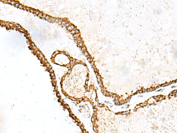 Rabbit Polyclonal Antibody to PDIA4