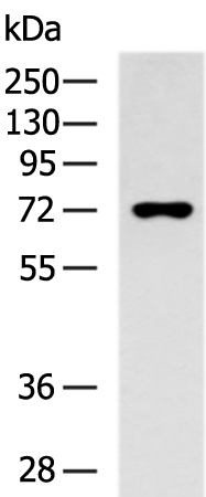 MAN1B1