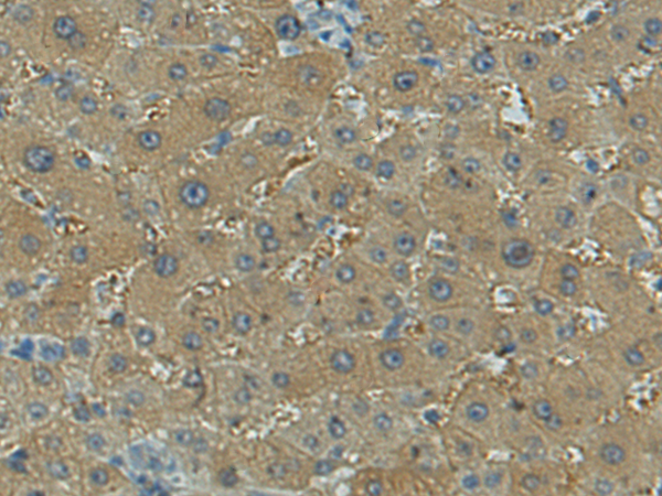 CFAP47
