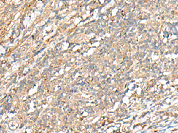 PCSK5