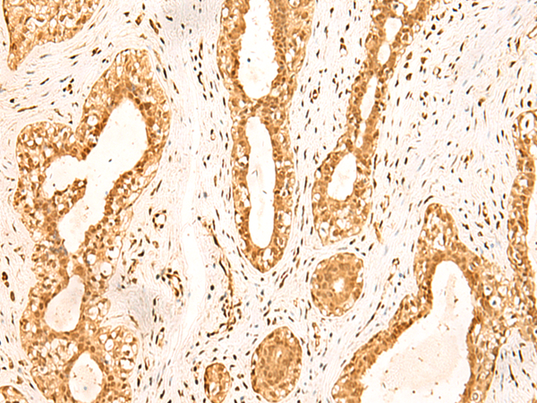 ZNF471