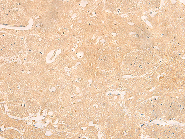 RNASE4