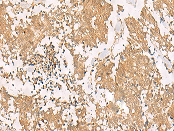PFDN2
