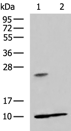 RPS27A