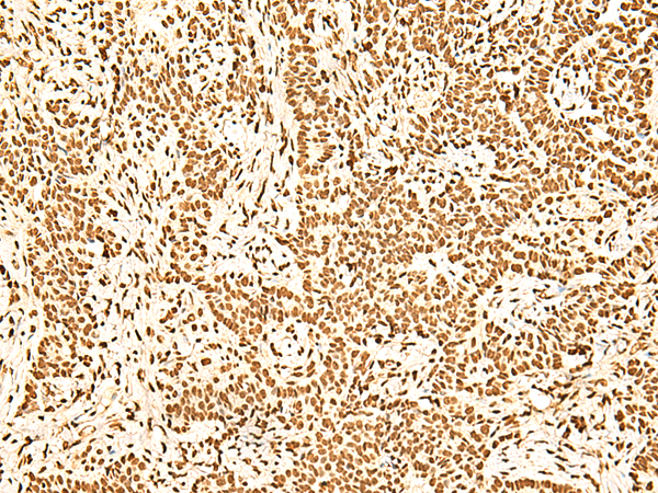 ILF3