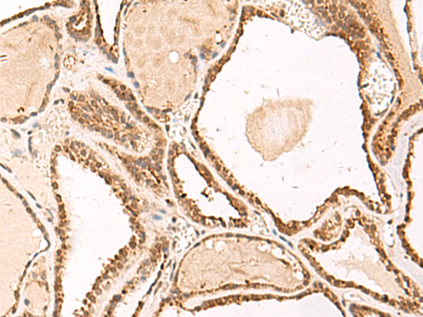 Rabbit Polyclonal Antibody to FUNDC2