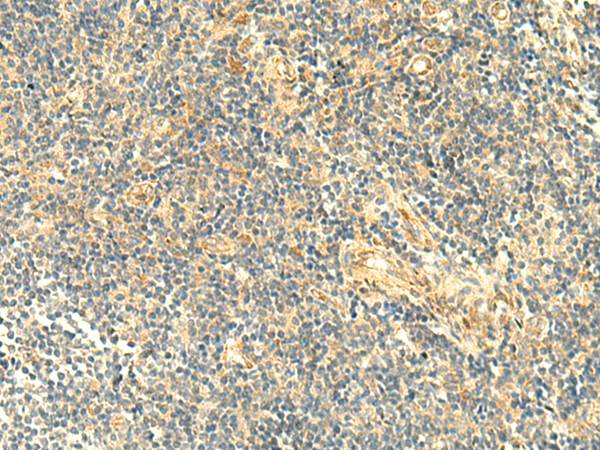 ASB6