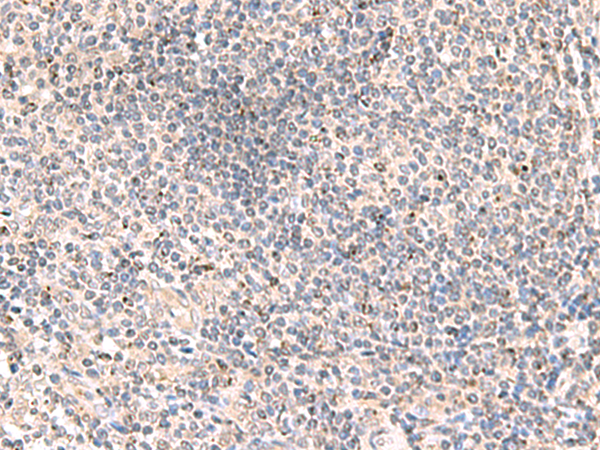 Rabbit Polyclonal Antibody to MLKL