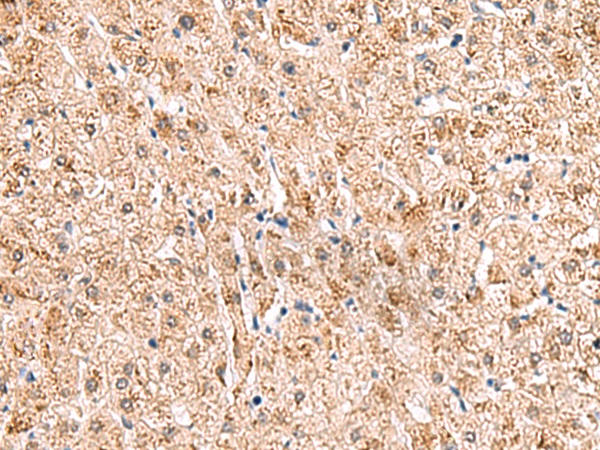 Rabbit Polyclonal Antibody to HCCS