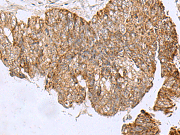 Rabbit Polyclonal Antibody to HCCS