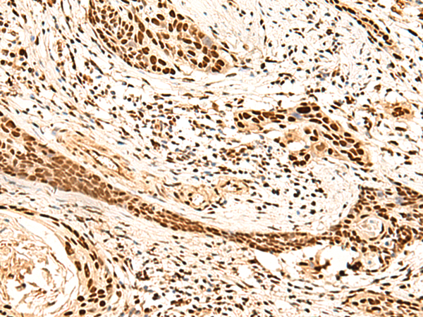 METTL1