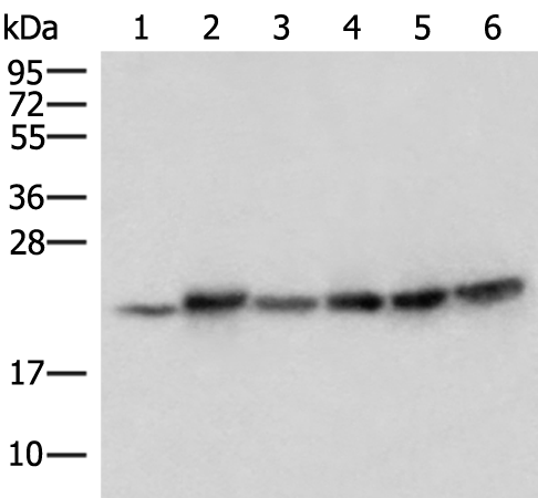 ATP5PD