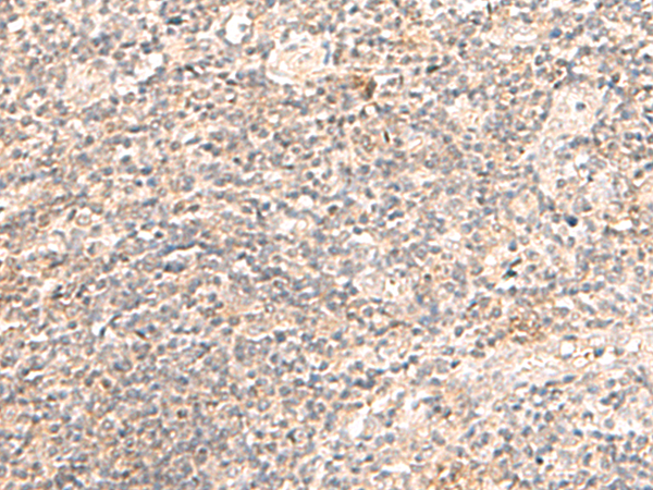 TRAPPC1