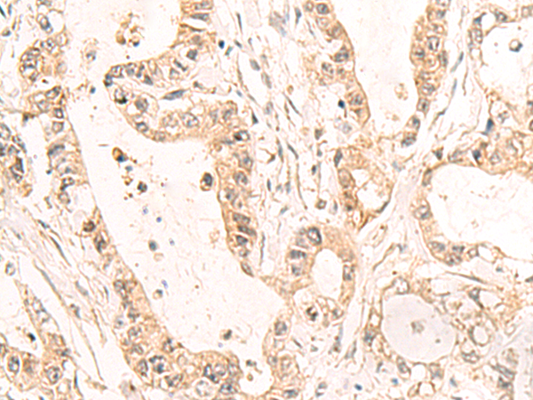 Rabbit Polyclonal Antibody to C19orf57