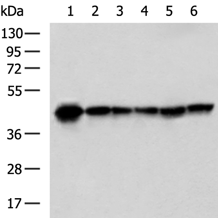 PDHA1