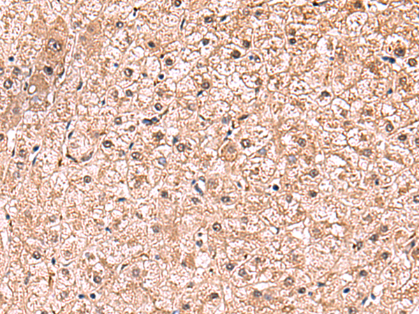 RUSC1