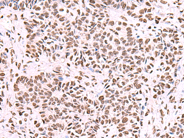 Rabbit Polyclonal Antibody to NASP
