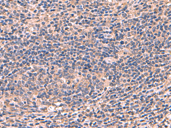 AHCYL1