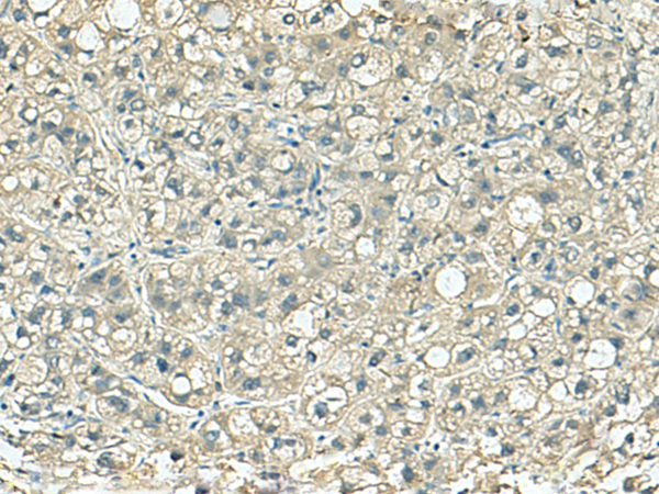 Rabbit Polyclonal Antibody to SORBS2
