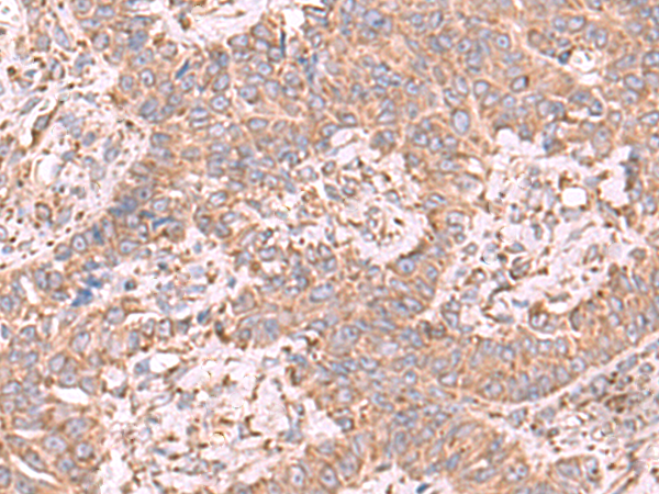 Rabbit Polyclonal Antibody to EEF1D