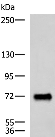 PPEF1