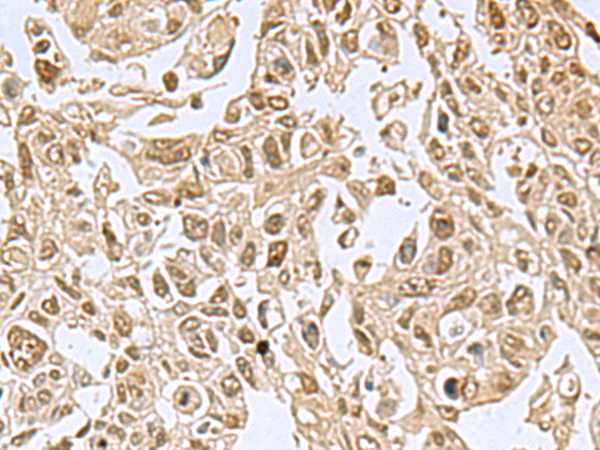 Rabbit Polyclonal Antibody to NVL