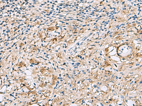 Rabbit Polyclonal Antibody to TMEM141