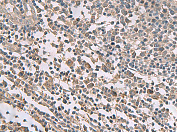 Rabbit Polyclonal Antibody to TMEM141