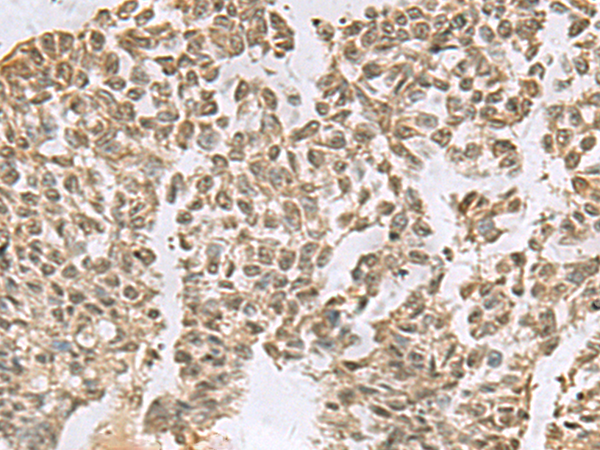 Rabbit Polyclonal Antibody to ELOC