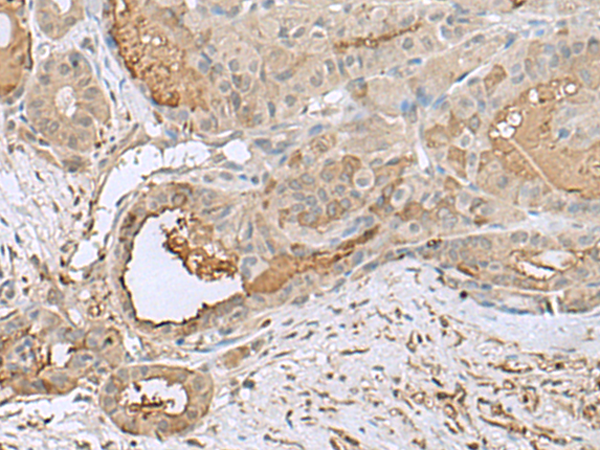 GABARAPL2