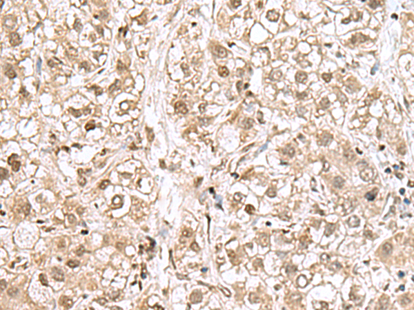 Rabbit Polyclonal Antibody to RPL35