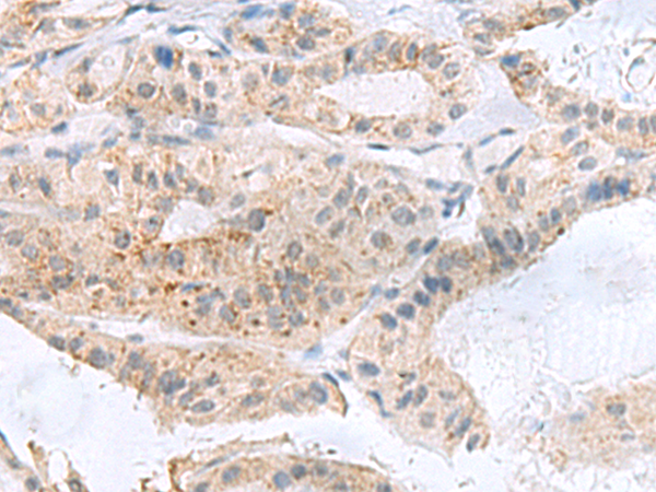 Rabbit Polyclonal Antibody to PHLDA3