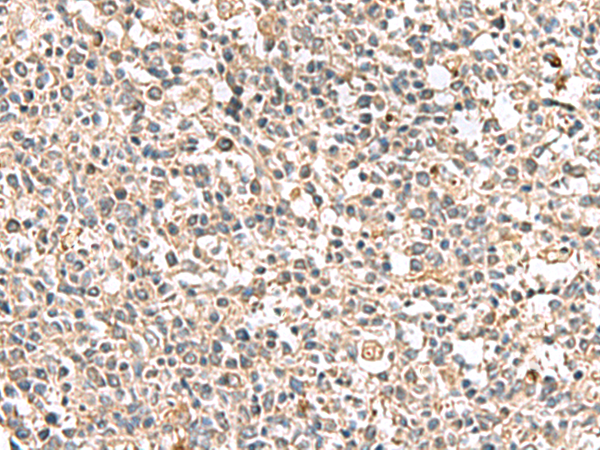 Rabbit Polyclonal Antibody to PTPRS