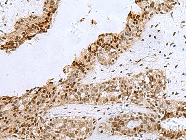 Rabbit Polyclonal Antibody to H2AJ
