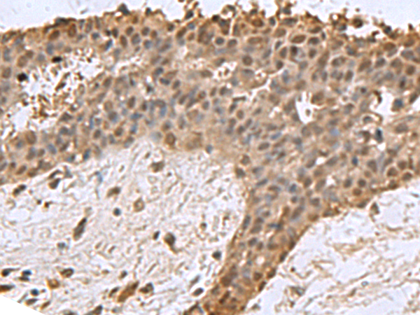 DCTPP1