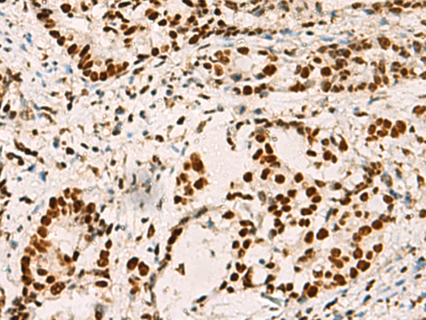 Rabbit Polyclonal Antibody to ELF5