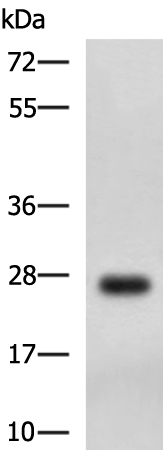 DHRS2