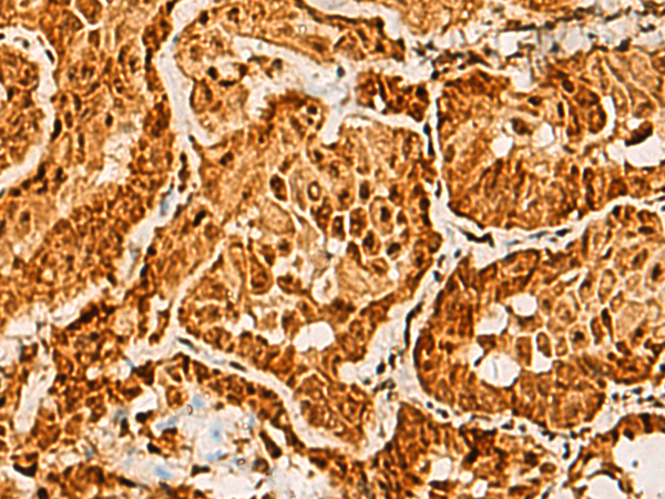 Rabbit Polyclonal Antibody to SAP30BP