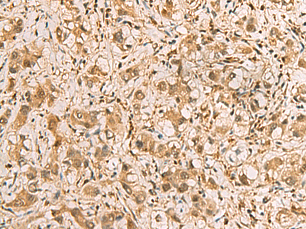 Rabbit Polyclonal Antibody to PDXK