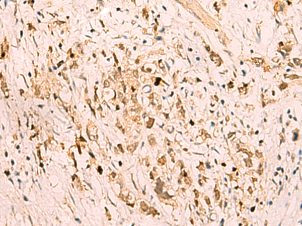 Rabbit Polyclonal Antibody to SGTA