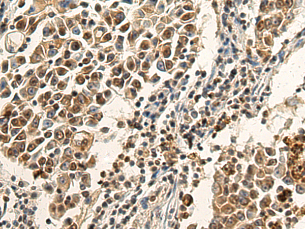 CD2BP2