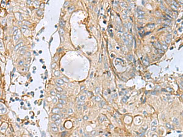 Rabbit Polyclonal Antibody to MTHFD2