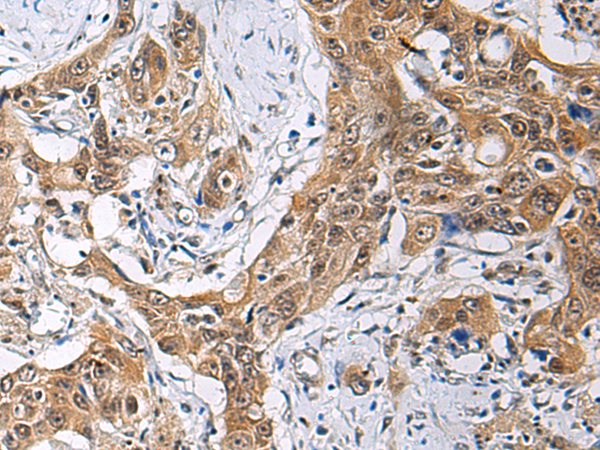 Rabbit Polyclonal Antibody to THOC3