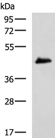 TMOD1