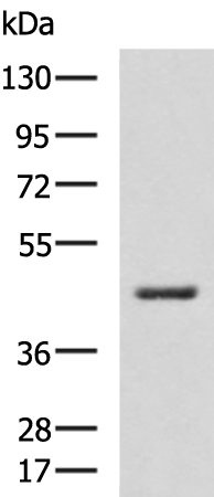 HSD3B2