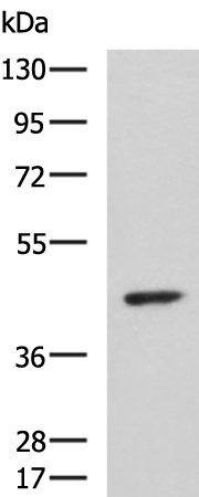 ARPC1B