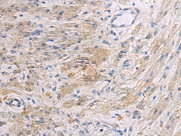 Rabbit Polyclonal Antibody to SLC30A3
